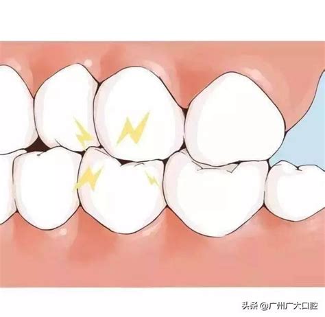 咬緊牙關意思